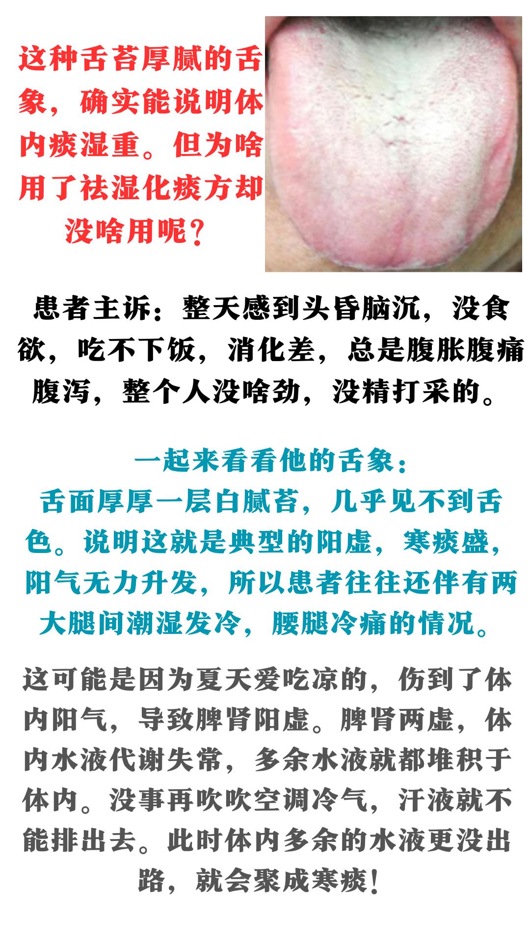 舌苔厚腻到这种程度，就别再只盯着二陈芄了，这个方法立马刮干净！#中药##健康科普