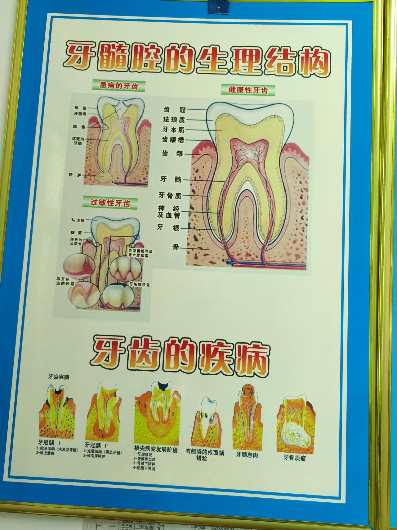 牙痛花了我120块！
  某专家说吸烟者说“烟不会牙痛”，纯属自欺欺人。焦油和尼