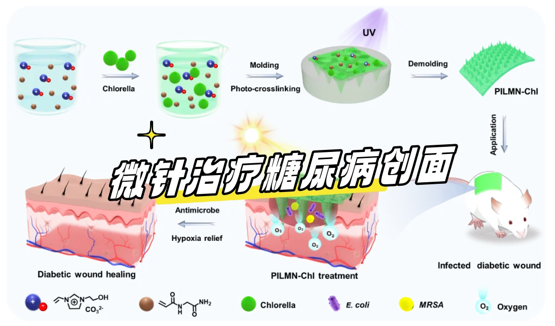 苏州大学：小球藻抗菌微针治疗糖尿病创面