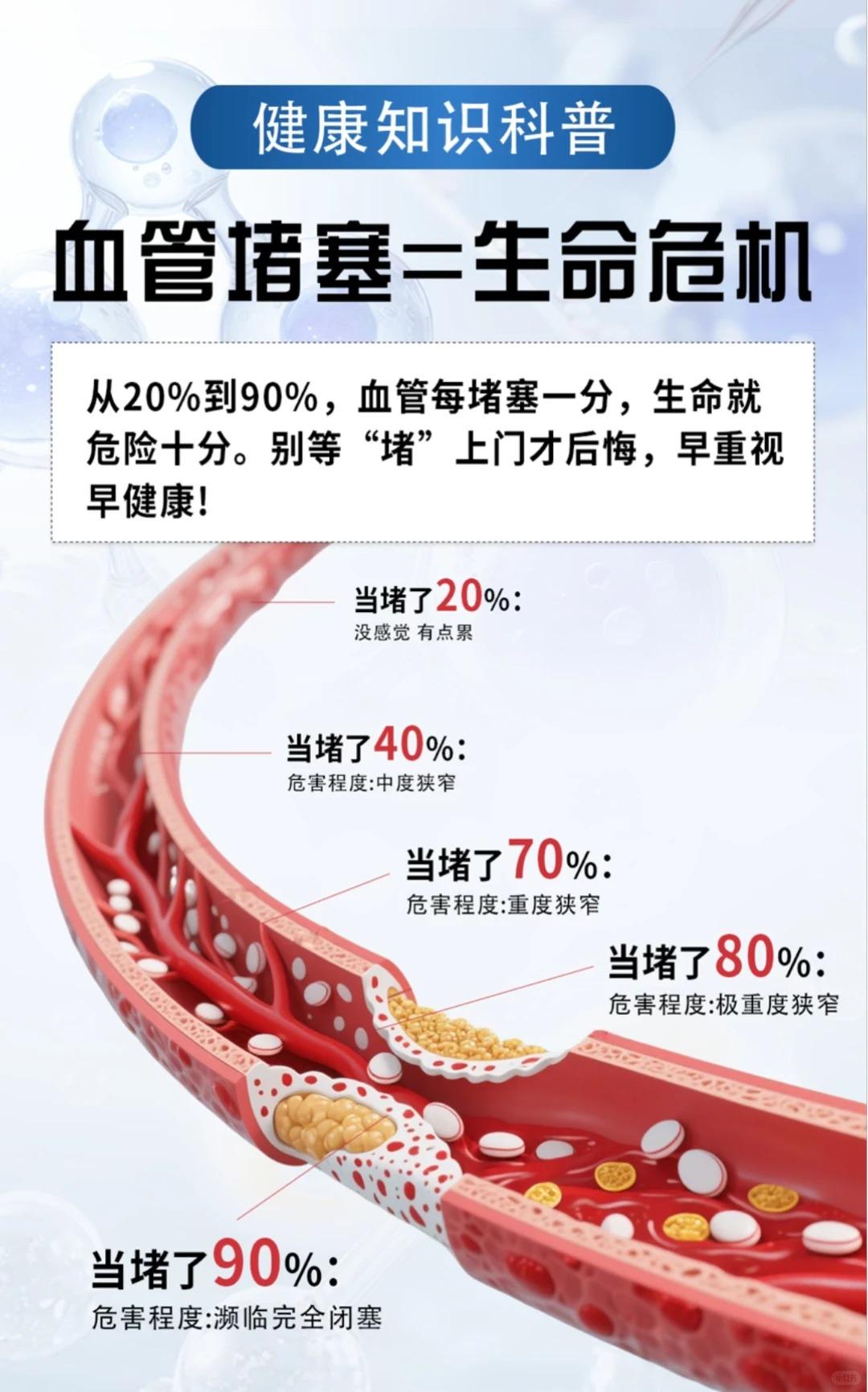 血管一堵，全身受罪！越早养护越健康！。