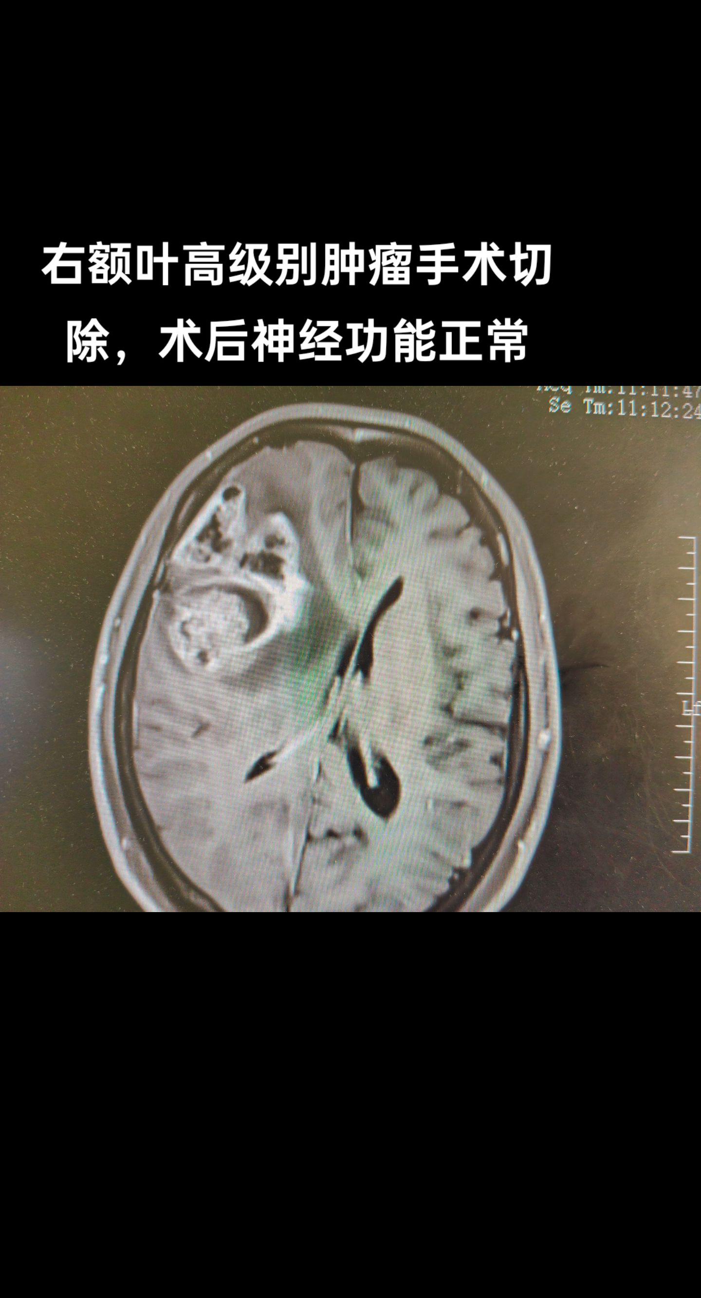医路前行 手术