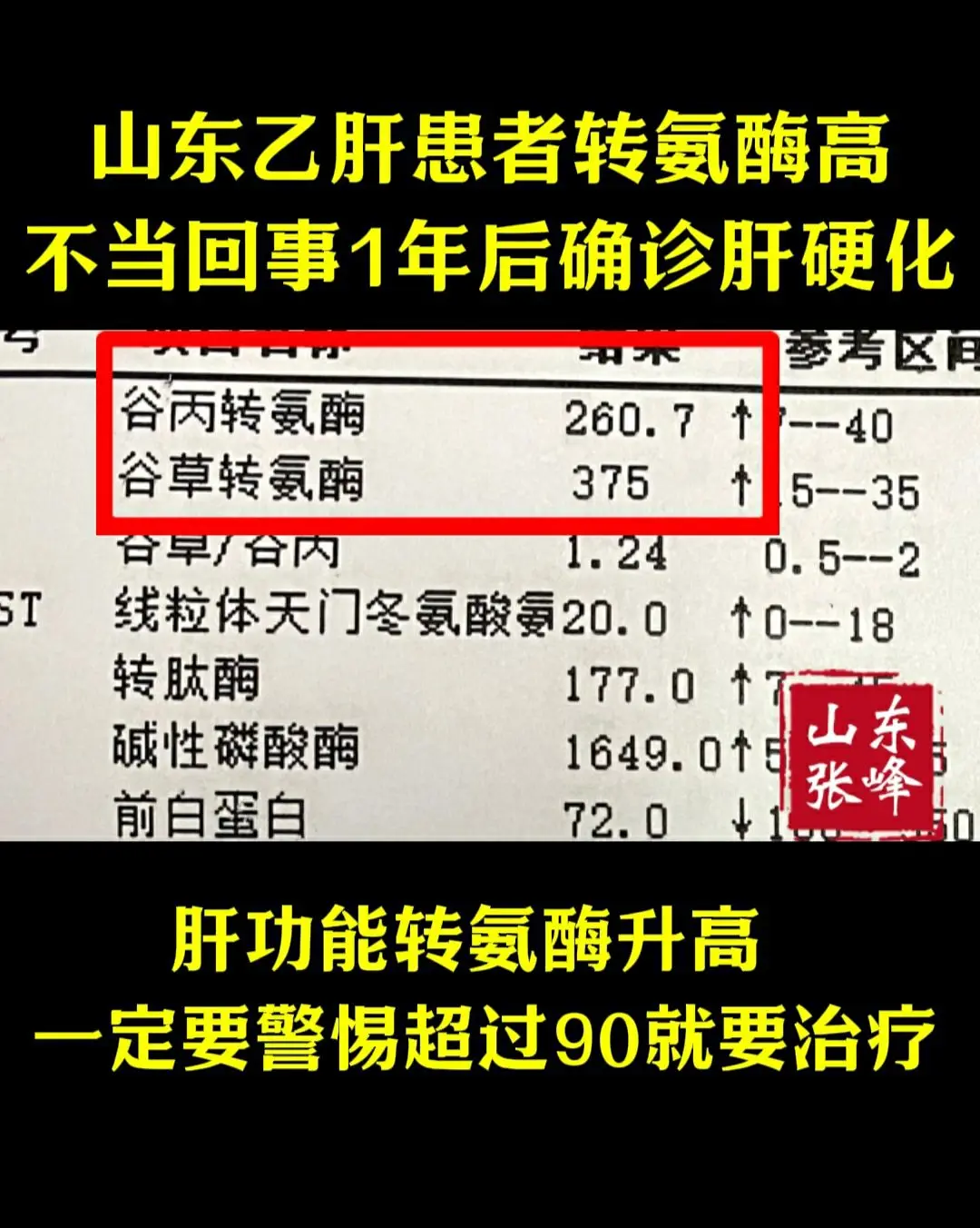 肝功能正常值是0～40，超过90就要引起足够重视！它的升高代表肝细胞大...