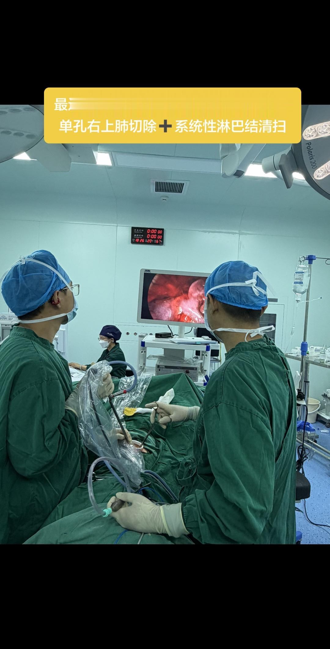最近手术不多，但是基本都是恶性…… 单孔右上肺切除➕系统性淋巴结清扫……