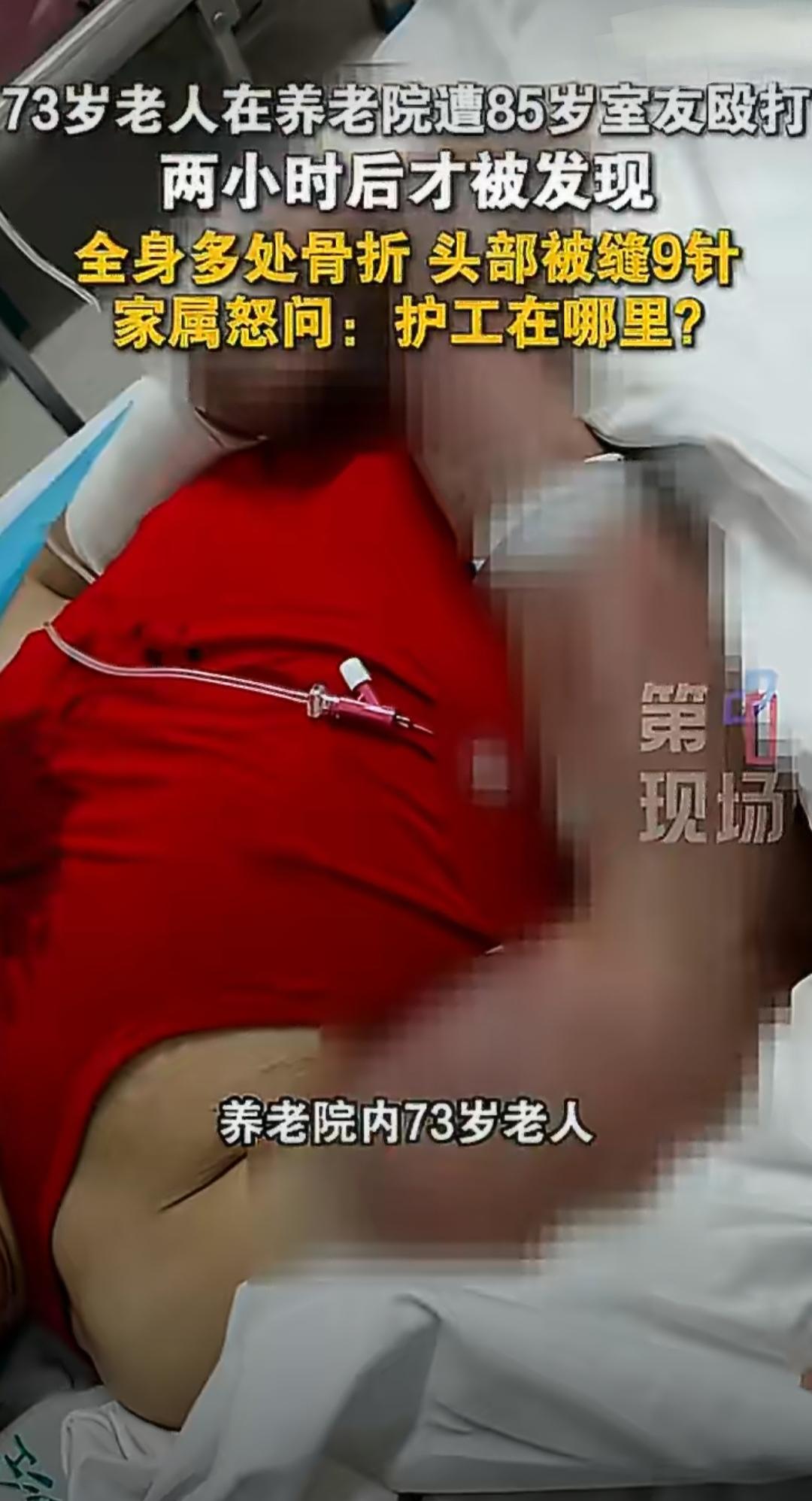 近日，内蒙古赤峰发生了一件让人气愤的事。马女士的73岁父亲在养老院里，被同宿舍8