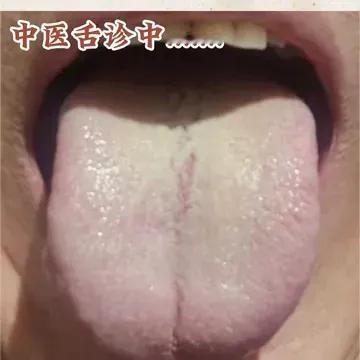 你是否常常感觉身体湿气重，腰膝酸软，小便发黄？今天我来告诉你，这可能是脾胃虚寒导