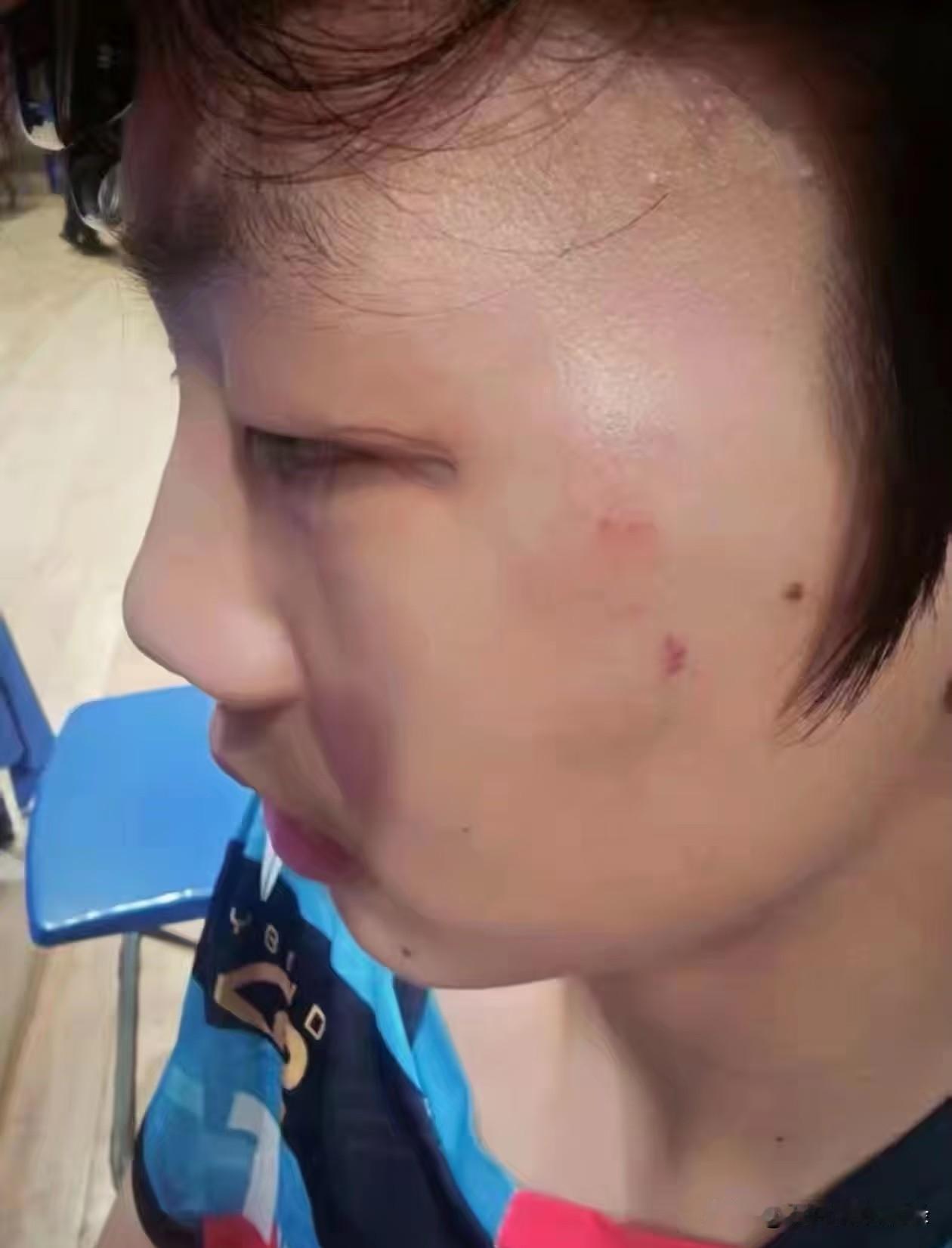 被曹彦灏打的小男孩，下手真的重。
这男孩子和曹彦灏本身是认识的，也一起打球，江苏