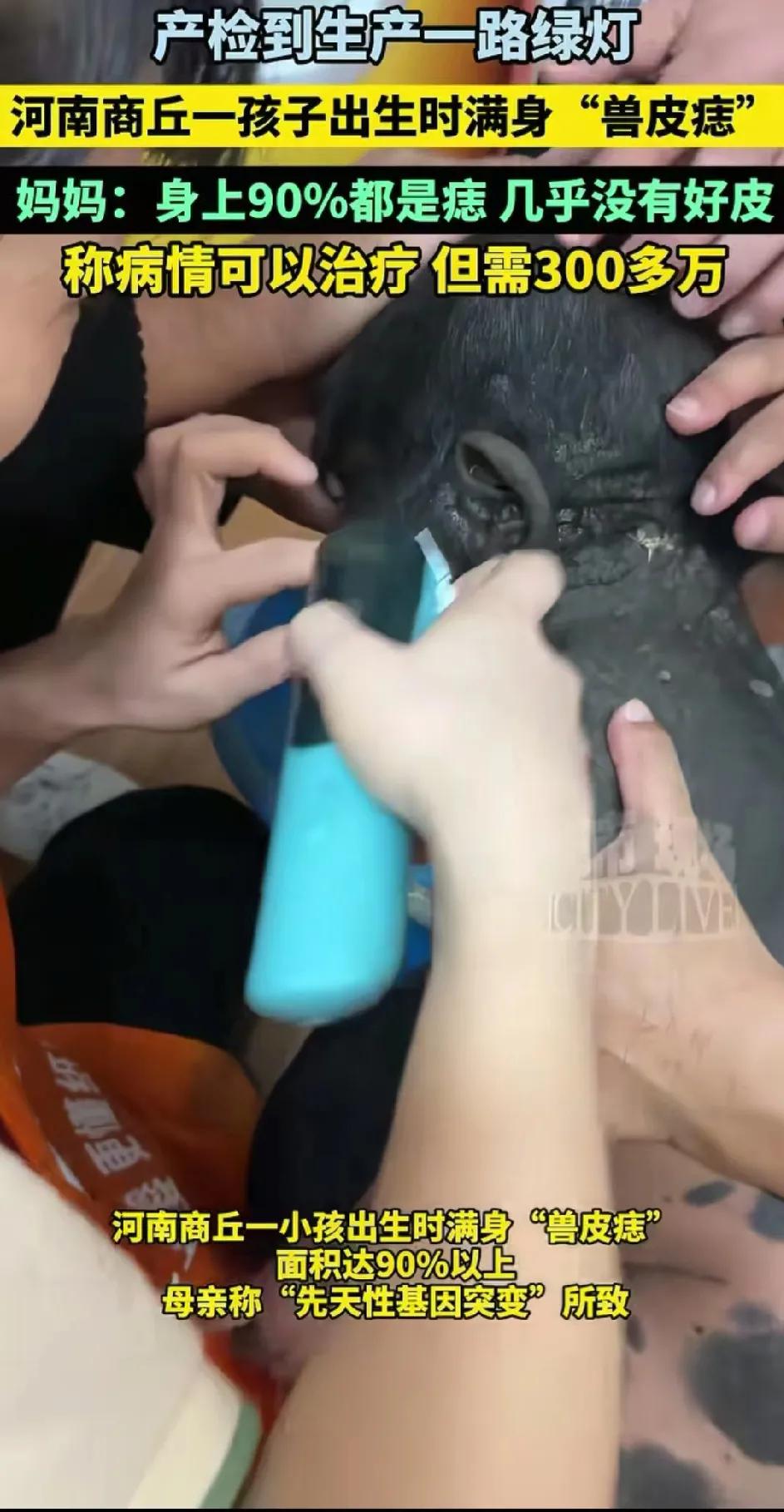 可怜的宝宝太让人心疼了
河南一宝妈，大儿子六岁的时候
不幸遇到车祸去世
一年以后