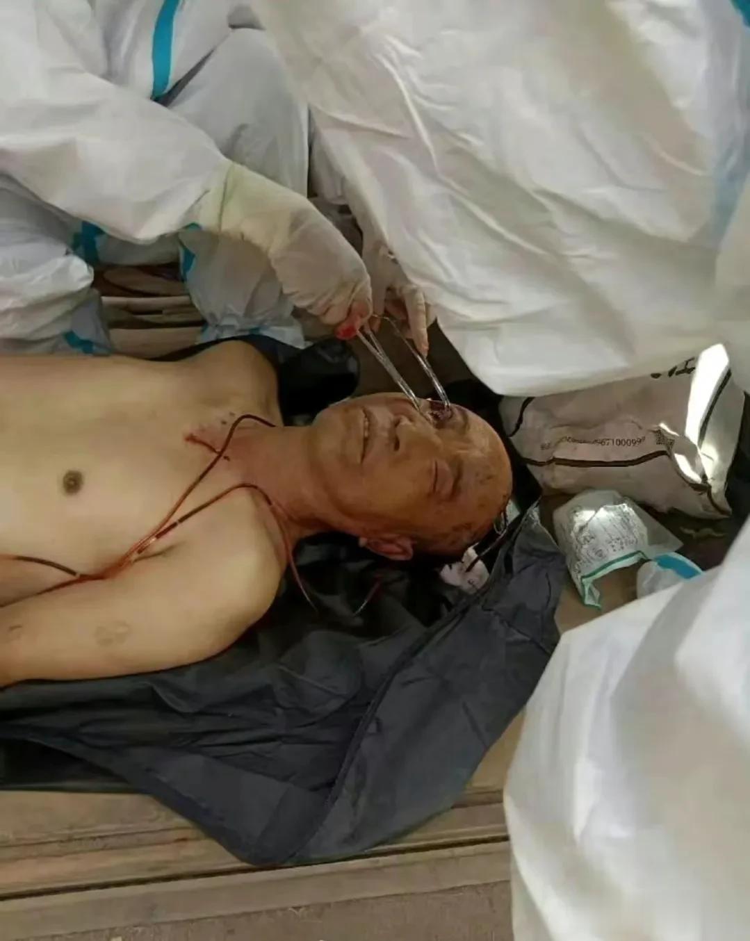 明学昌畏罪自杀一切都显得理所当然。
只有死人不会说话才没有威胁，他的死因也能解释