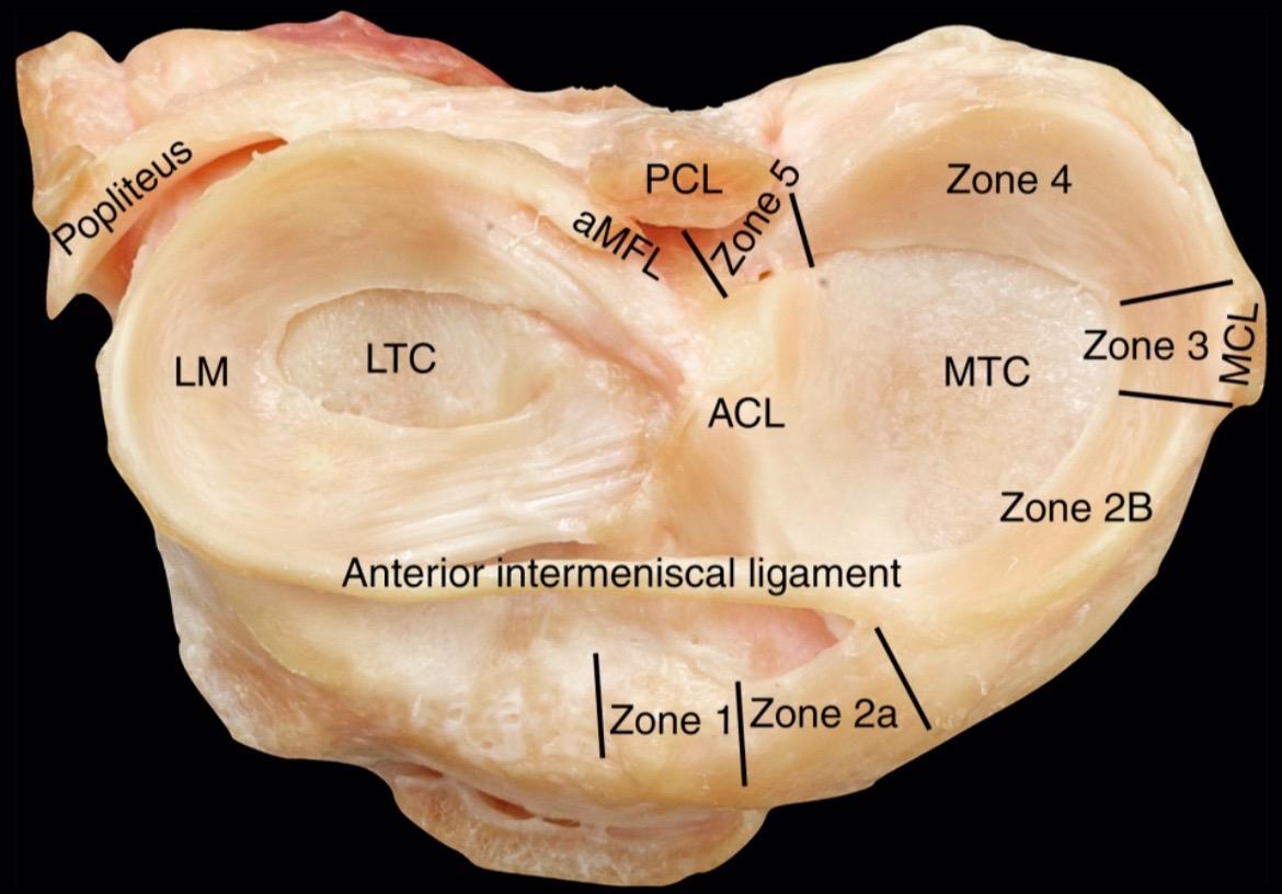 半月板解剖。半月板撕裂 关节镜