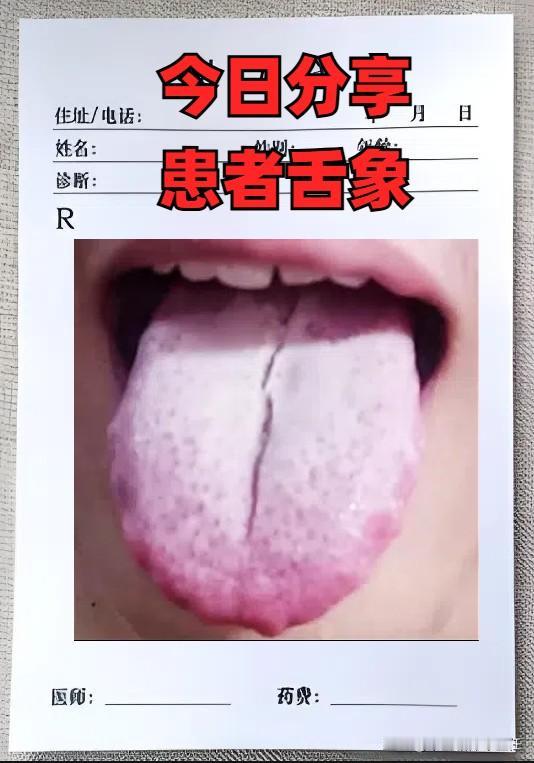 不再用手，时间就能恢复？看完这位朋友的舌象，你就就知道了！

9月份来个了20多