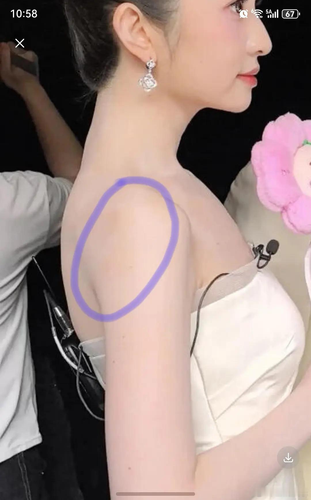 徐如兰怎么还肤色分配不均啊，是不是全身都抹粉了 