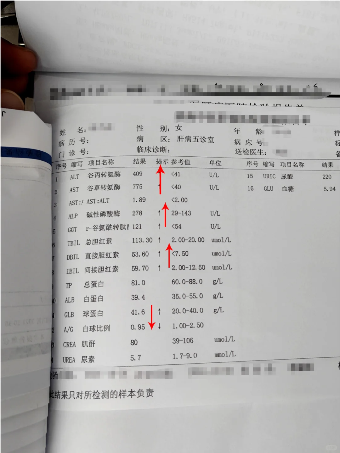 医生最怕：肝病检查报告上出现这7种提示！