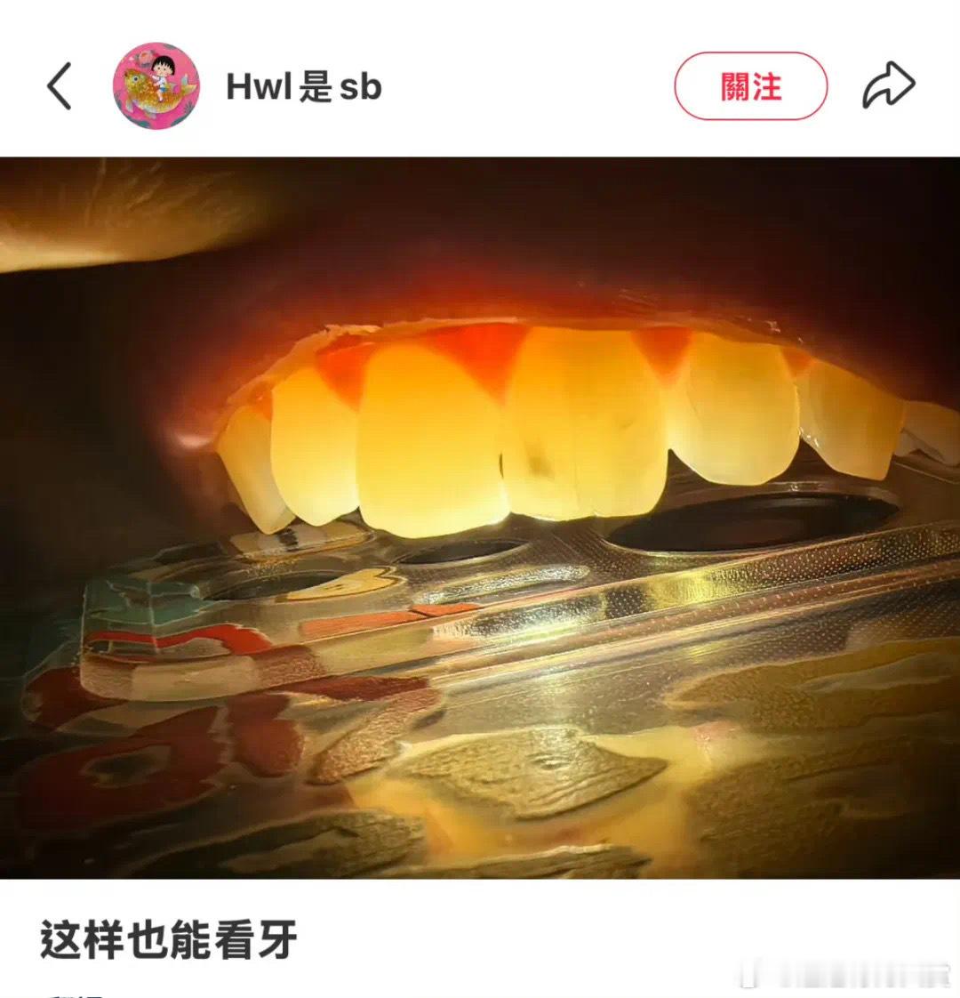 原来自己也可以给自己看牙…… ​​​