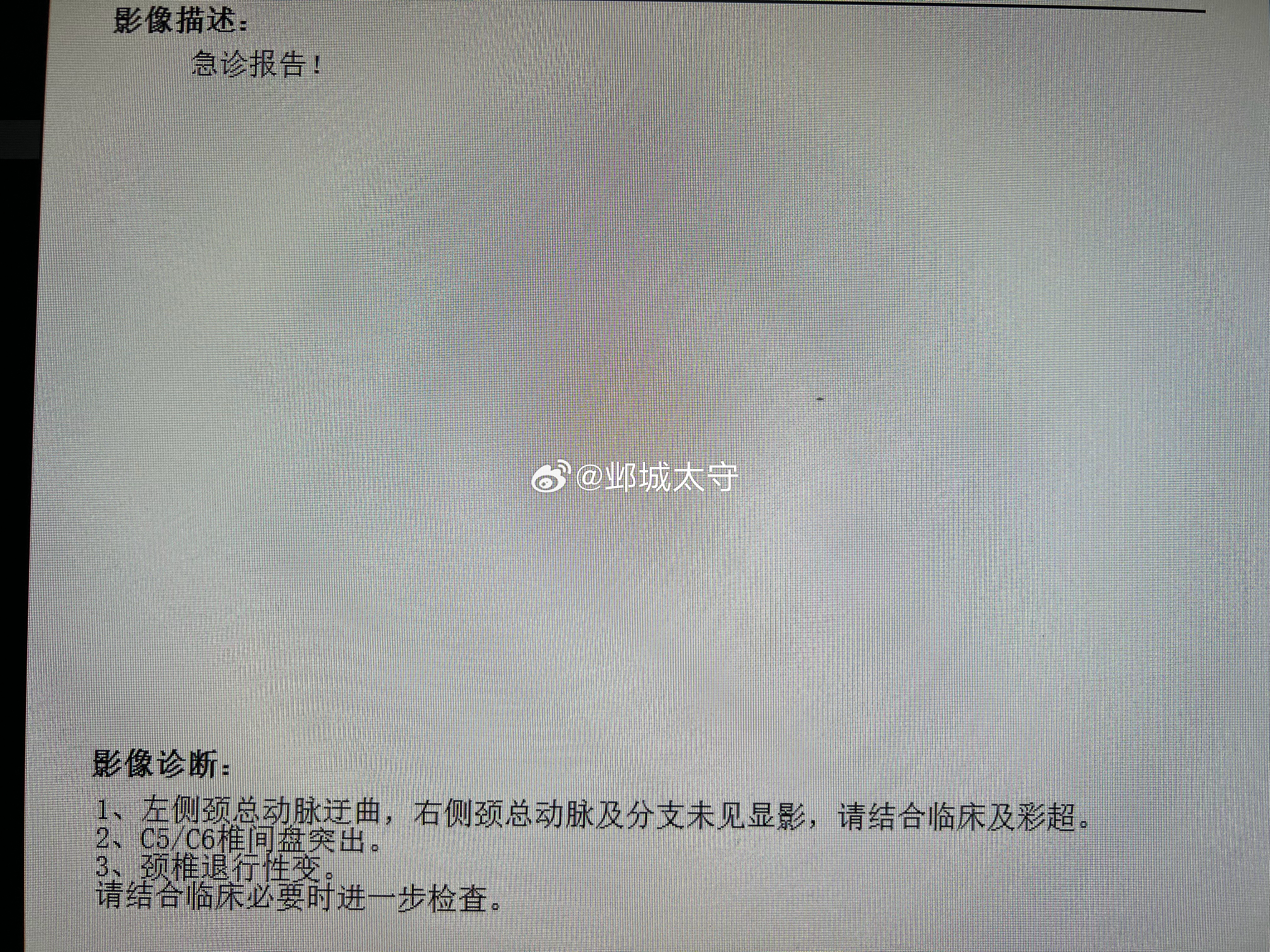 急诊的兄弟喊我去会诊，有个病人的核磁报了右侧颈总动脉及分支未见显影，一进急诊满满