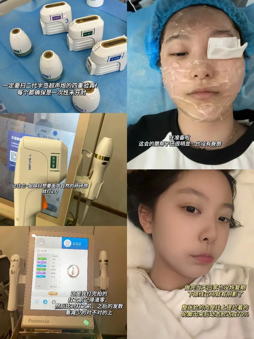 高级紧致的幼态脸，才是真微do天菜啦