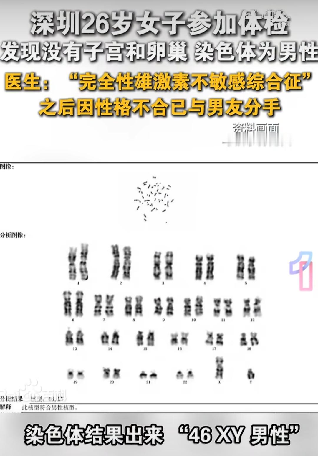 有个在深圳工作的26岁女生李李，从小到大一直觉得自己是女生，外表、穿着、生活习惯