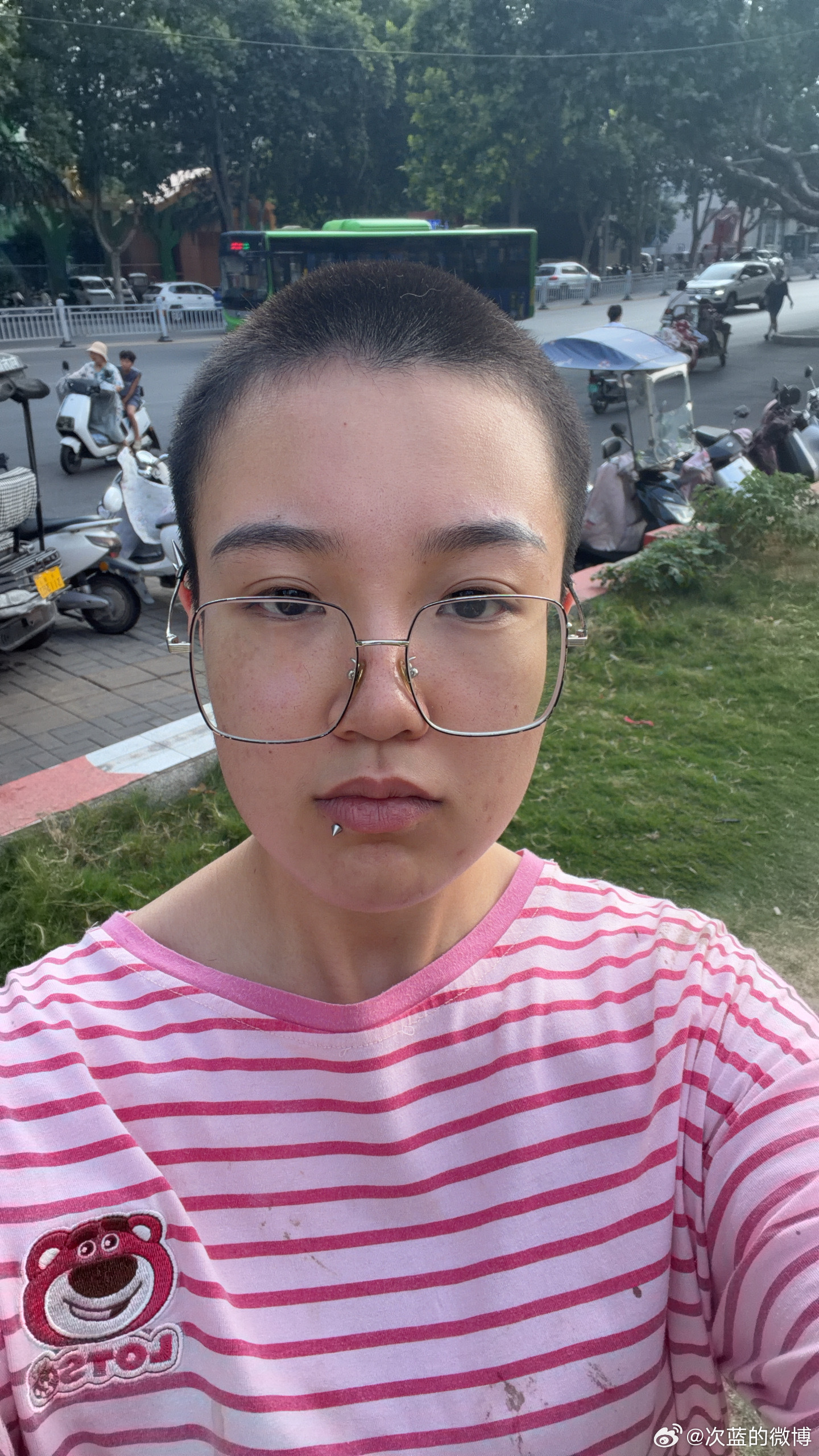 7.13➡️8.17头发加油 