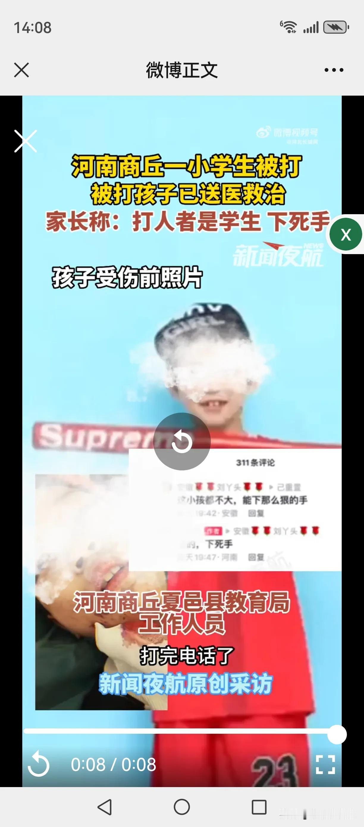应该好好教育一下，这么小，下手就这么狠，长大了那还得了啊！