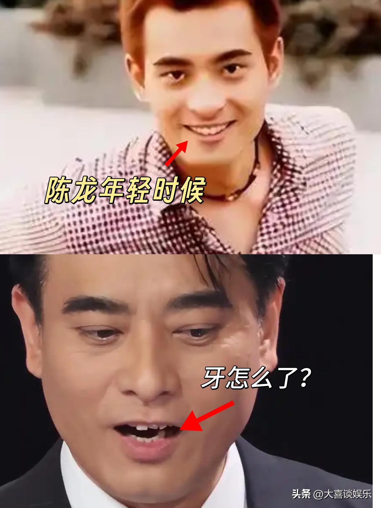 演员陈龙的牙突然变得七扭八歪，乍一看像个老人，可是他刚49岁啊！

有句话叫“人