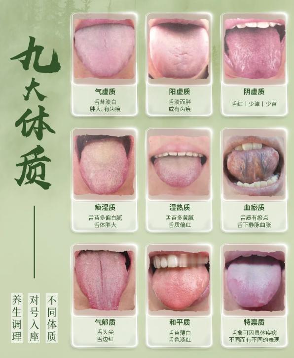 通过舌象辨体质，先拍先分析，你发我就看！

现场出结果，拍的越清晰，结果出的越快