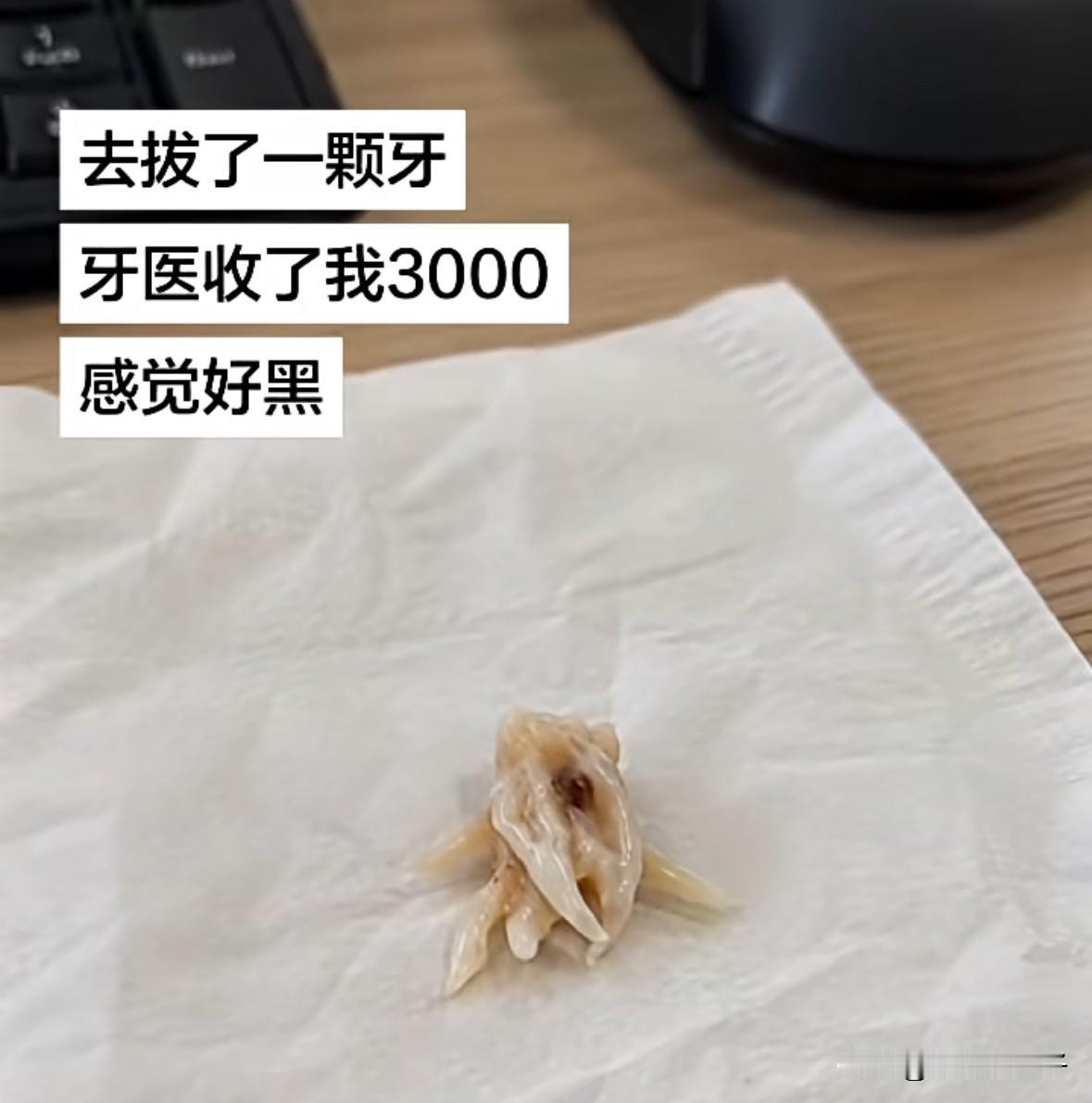 富人啊，竟然在嘴里种人参[捂脸]