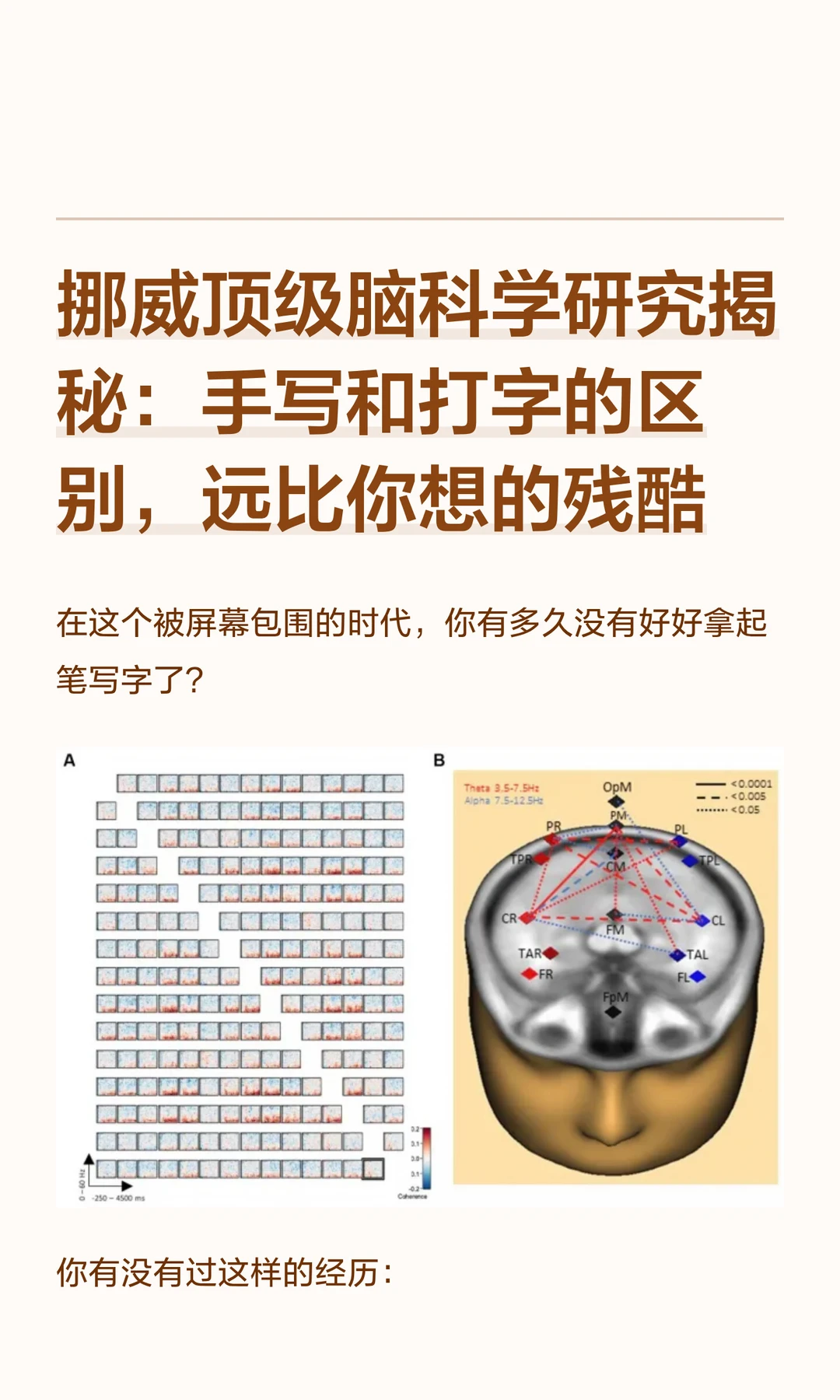 手写 vs 打字：一支笔就可以唤醒你的大脑