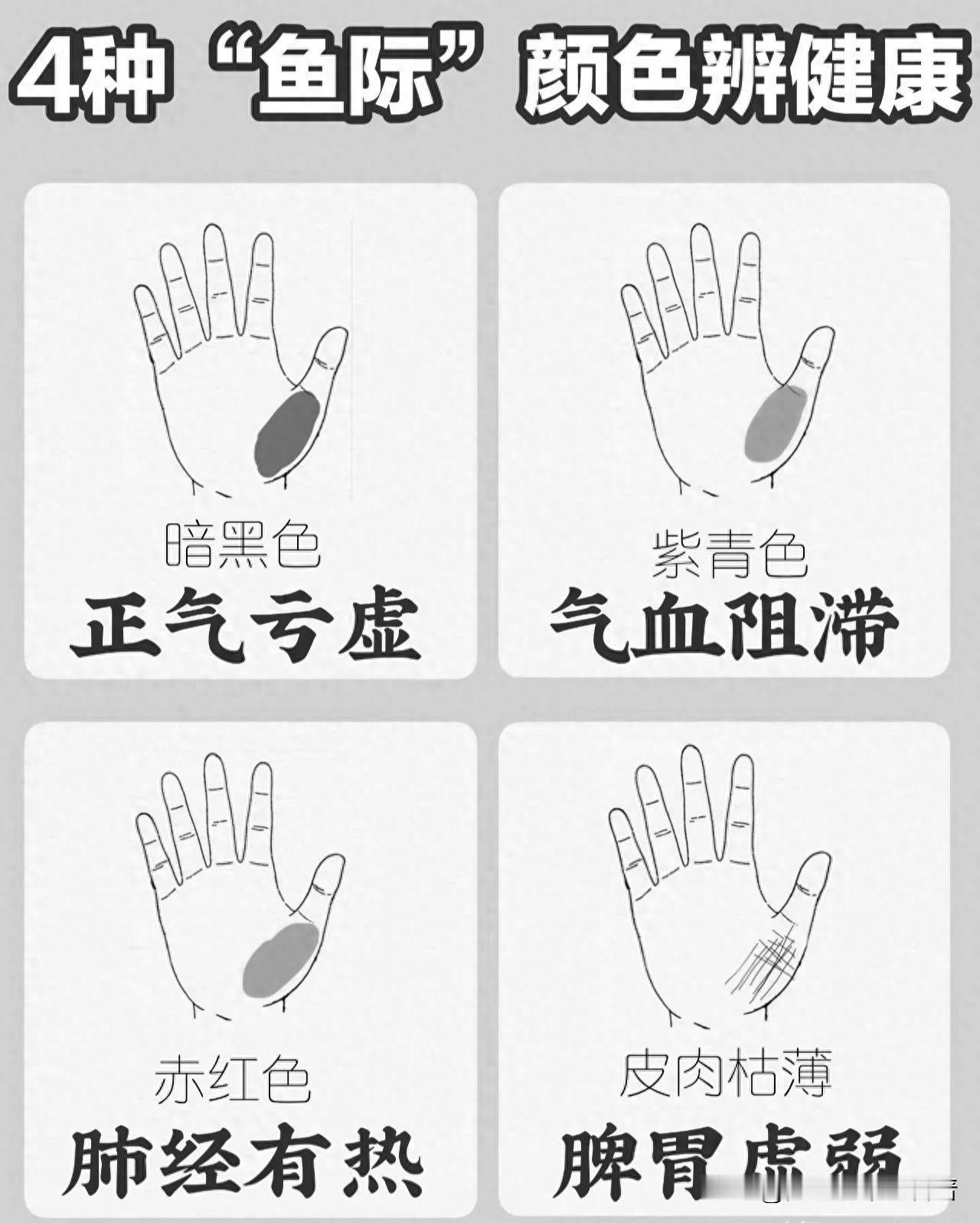 鱼际颜色透露健康秘密，4种变化你不可不知！