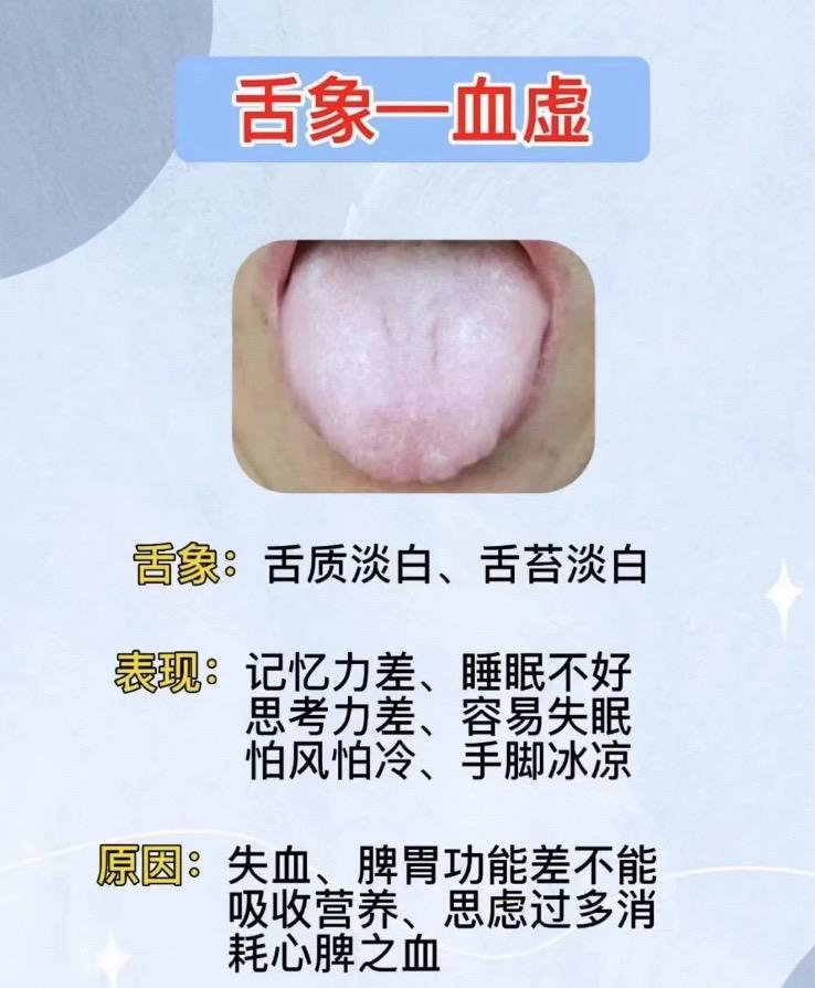 挑战十月份看够999个舌象，已经第15天了，今天有空，可以分析，直出结果！

注