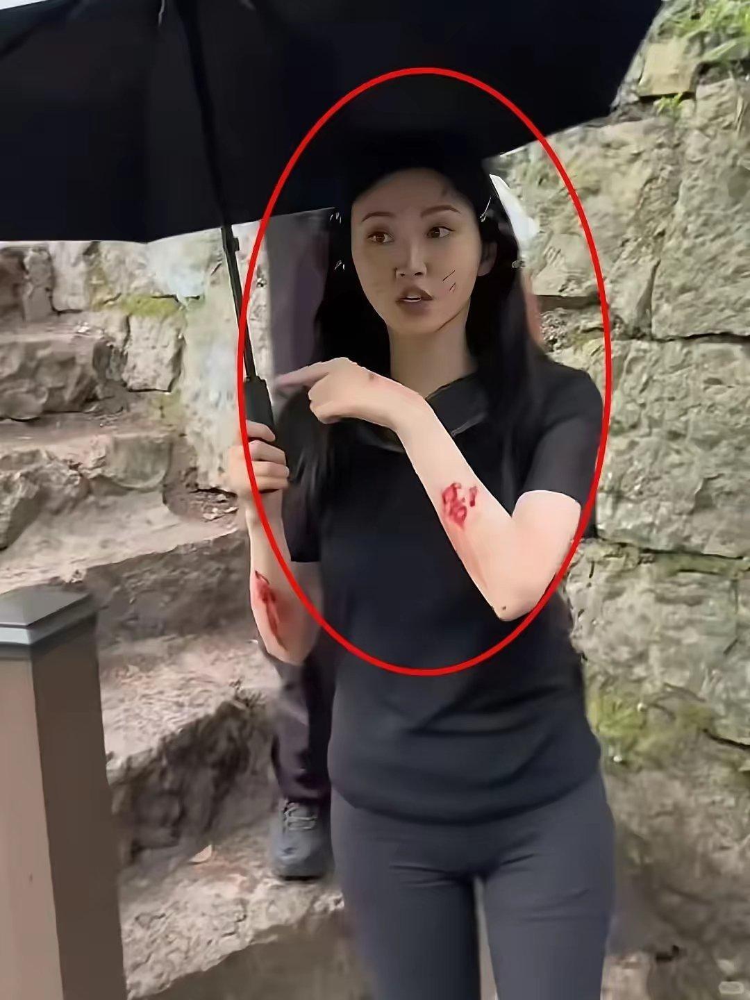 我天，景甜这手怎么了，怎么全是血 ​​​