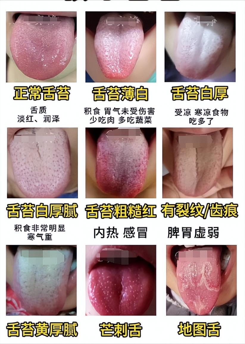 挑战一下，一天看100个舌头，你拍舌苔，我分析！
最好早上拍，注意不要开美颜，以