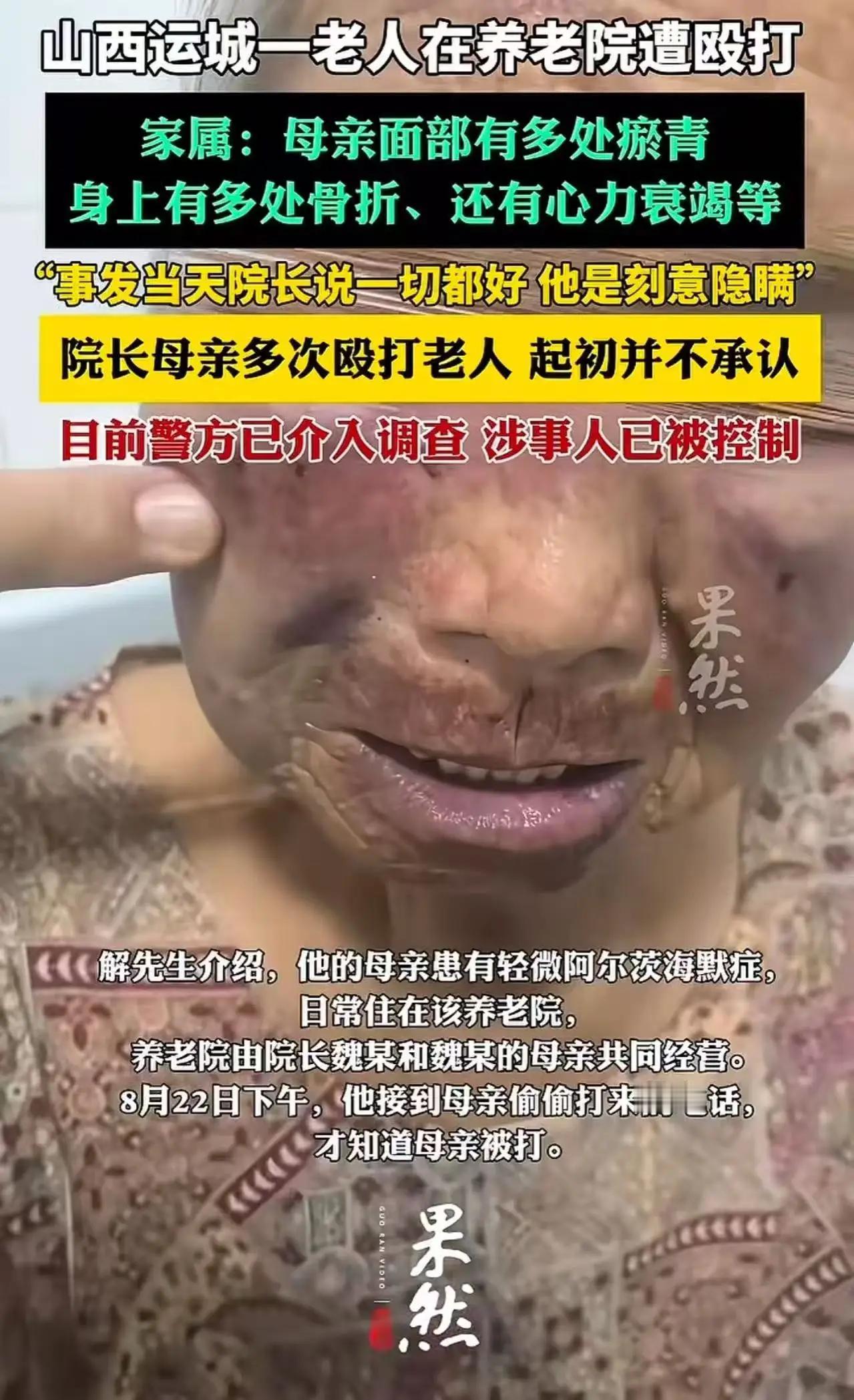 山西运城icon，八旬老人偷偷给儿子打电话，说自己被养老院院长的母亲从凌晨3点殴
