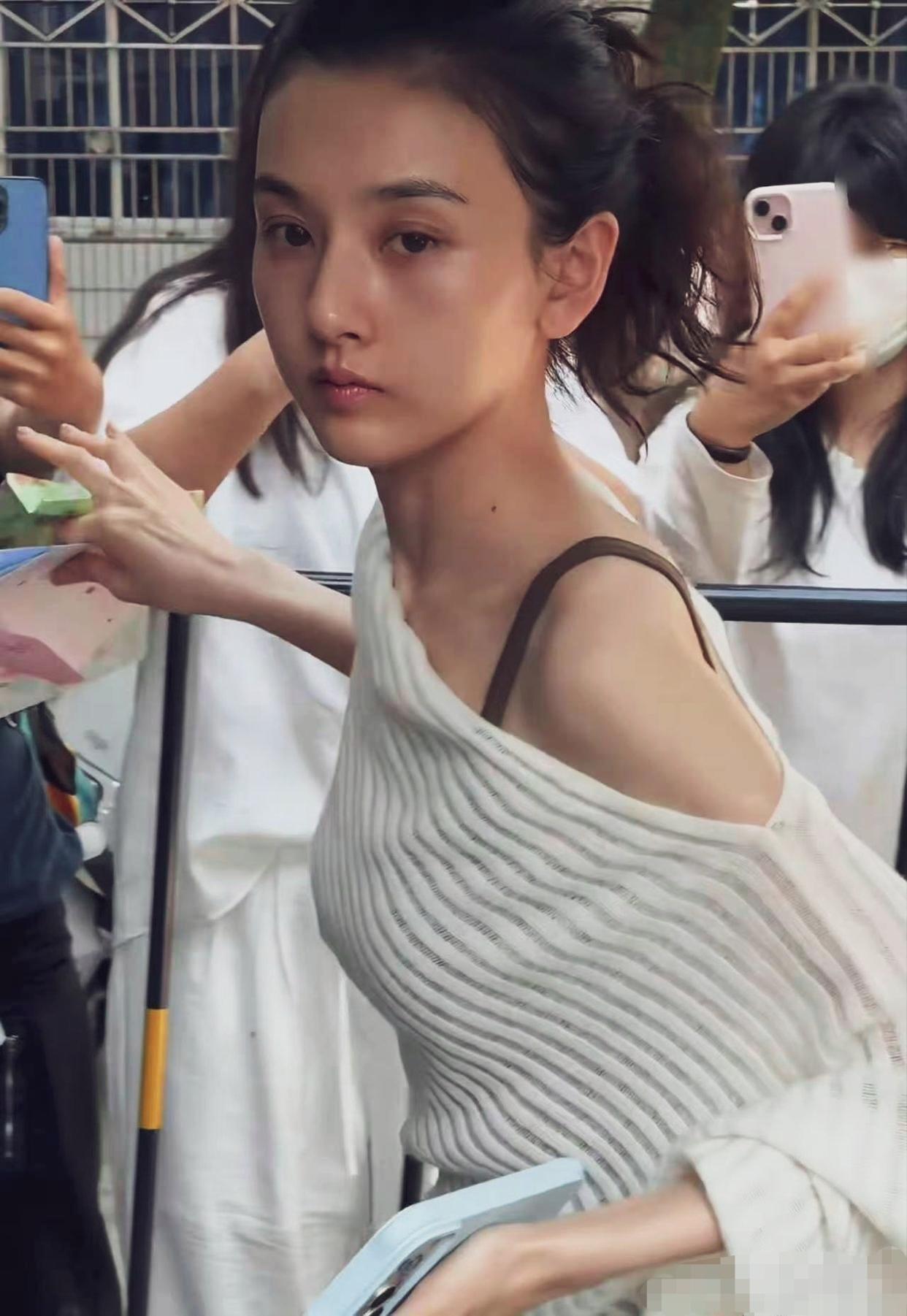 宋祖儿素颜照，面黄肌瘦，一营养不良的样子！