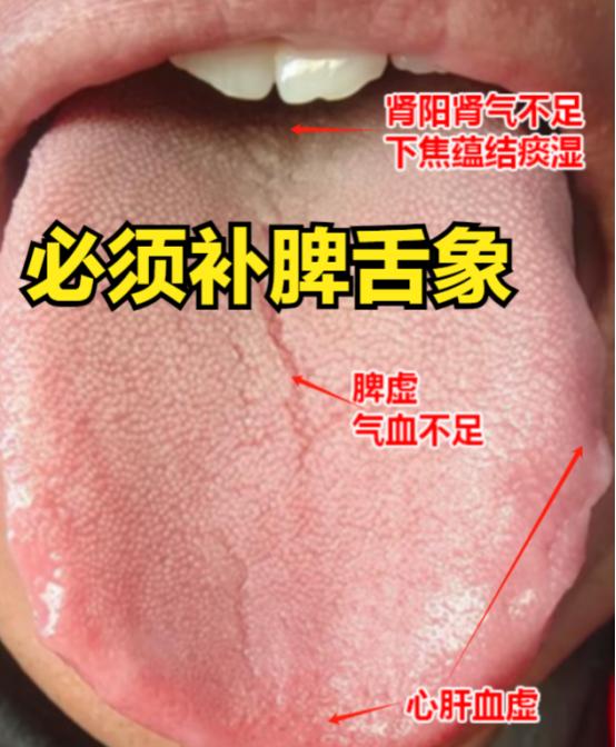 补脾就是给汽车加油，健脾就是给汽车保养！
要想汽车跑得快，首先动力要充足，其次零