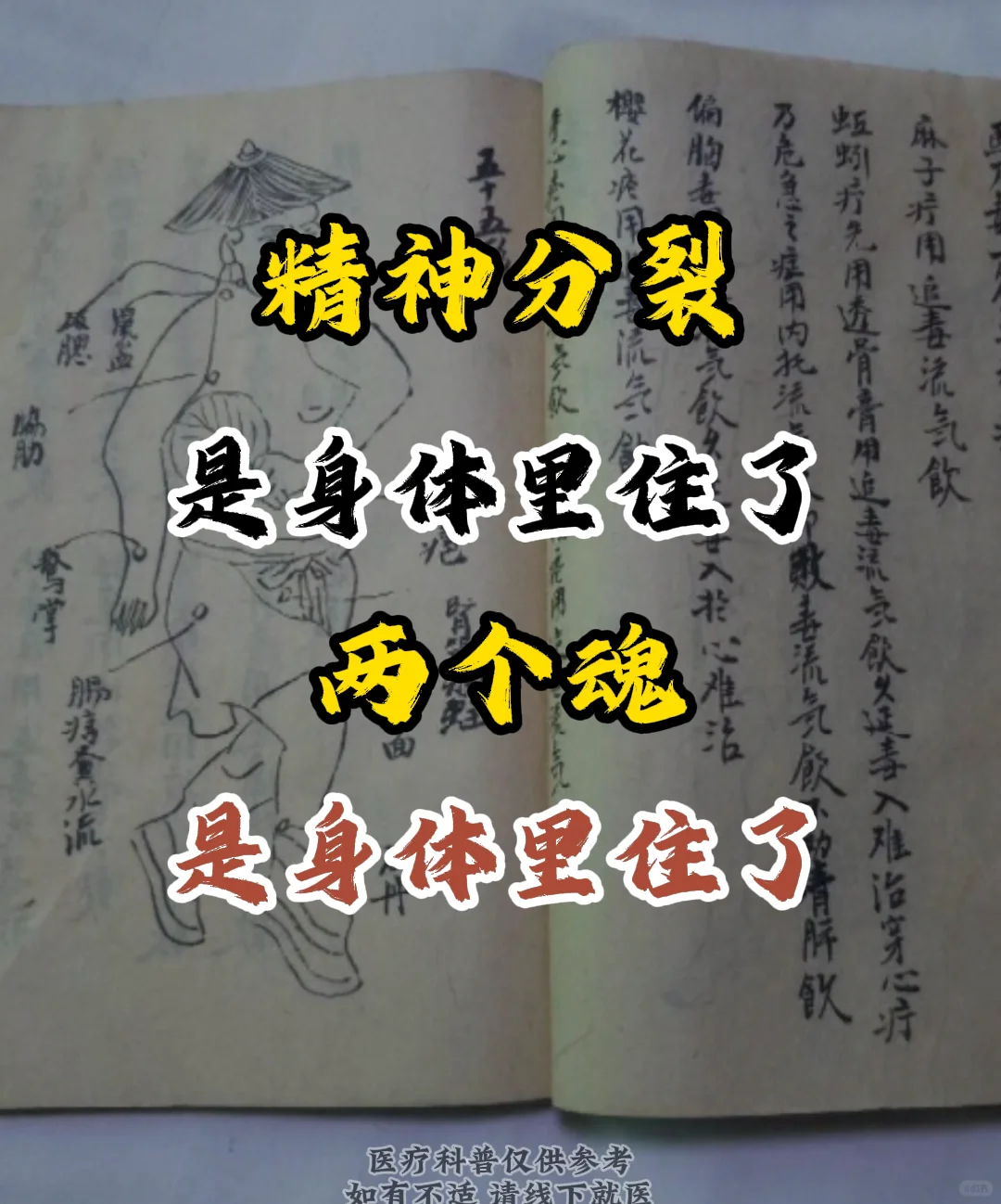 1.调和阴阳平衡：中翳疗法运用药材与针灸等手段，旨在调整患者体内的阴阳...