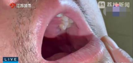 “离大谱！”江苏南通，一男子去口腔医院拔牙，医生说5分钟就能拔完，结果硬生生拔了