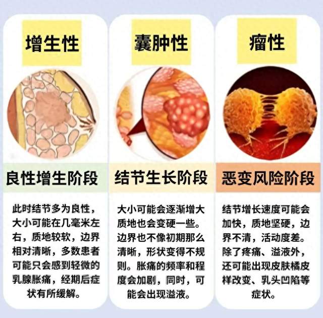 乳腺增生、结节、囊肿、纤维瘤，一次分清不焦虑｜乳腺疾病系列