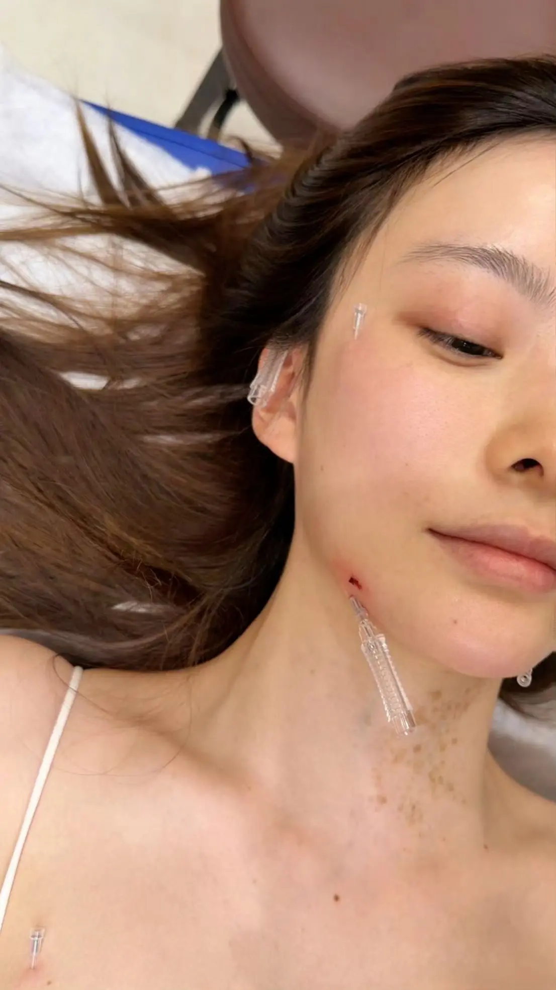 快点好起来吧！心疼😣😭。