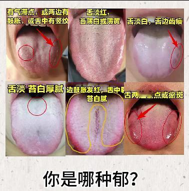 “六郁停、百病生”，六郁到底是怎么回事？一看便知！
 
1、肝郁----有气滞点