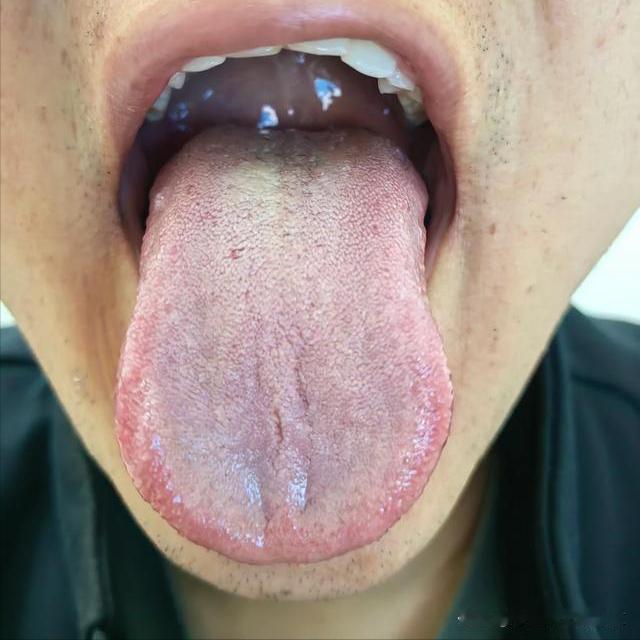 大哥你这不是状态不行，舌头都向你诉苦了，赶快注意点吧！[泪奔][泪奔]     