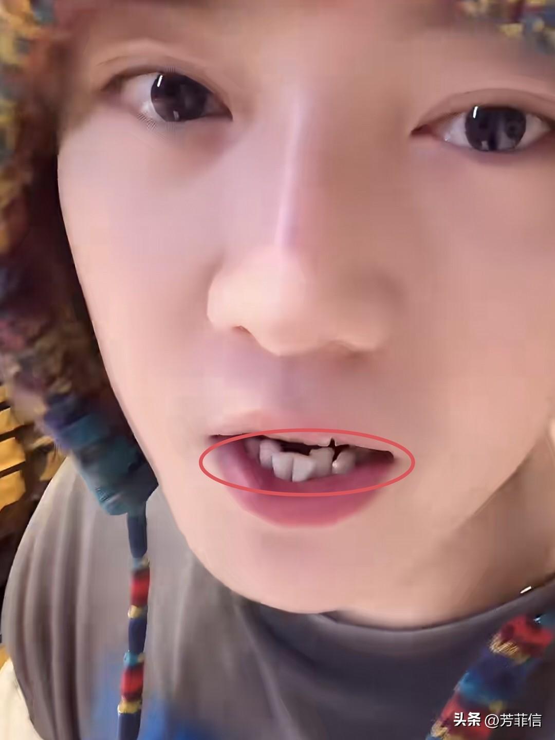 好家伙，鹿晗的牙齿居然是这样的吗？这也太杂乱无章了，差点没敢认，潜意识里认为爱豆