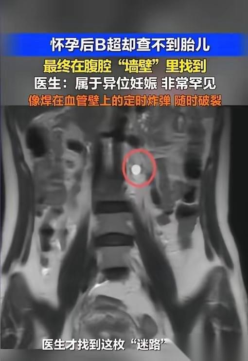 “太惊险了！”5月7日报道，广东深圳，一女子用验孕棒发现自己怀了，她赶紧去了医院