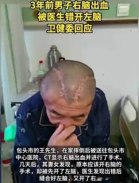 这可是开颅手术，居然也能搞错，右脑出血，主刀医生竟误认为是左脑。左脑开完，再开右