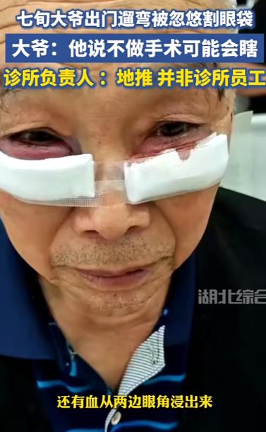 离了个大谱！”重庆，一大爷散步时，遇见一男子和他搭话，告诉他必须把眼袋做了，不然