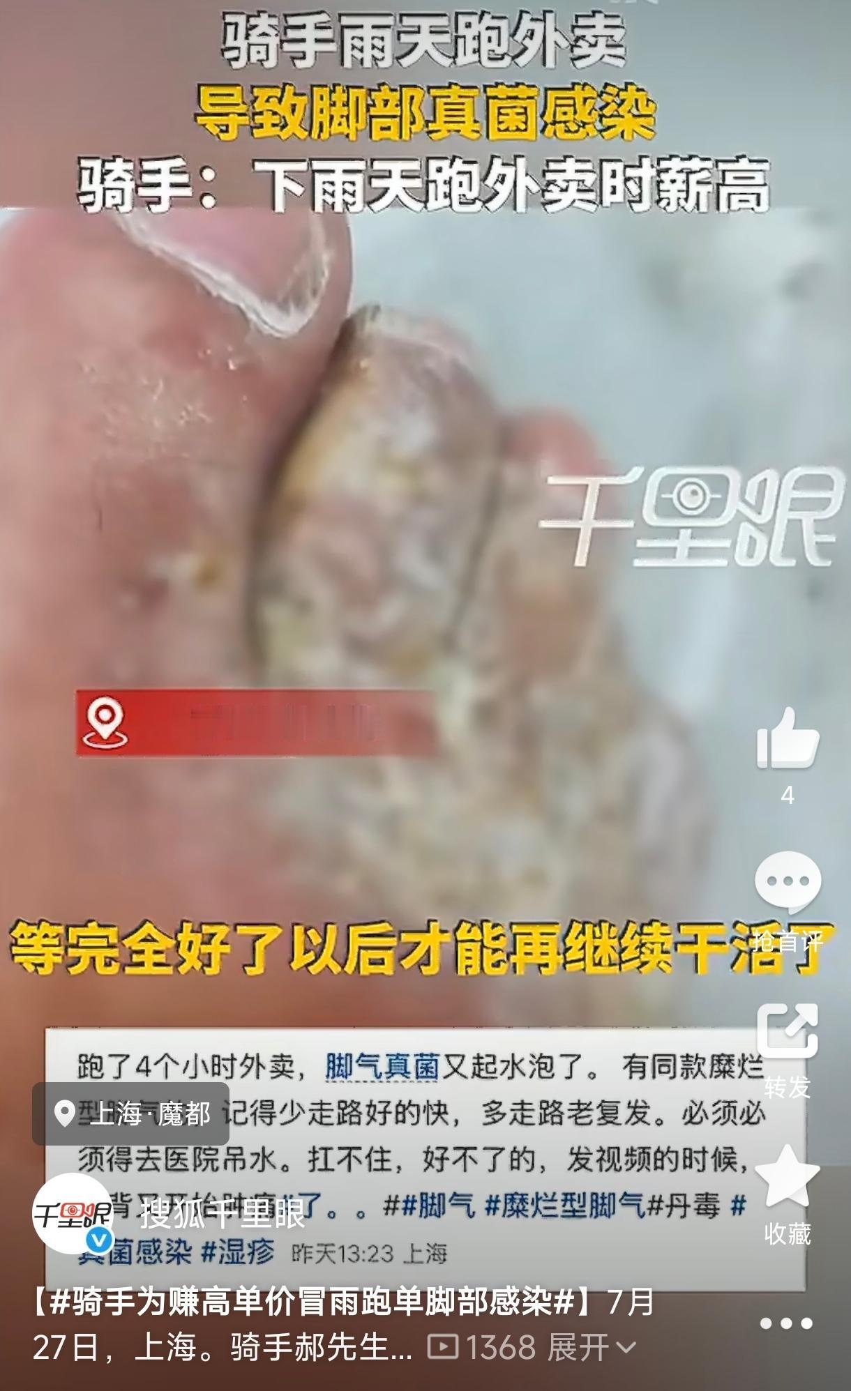 太拼了！上海，一外卖小哥为了赚取雨天高单价，连续多日冒雨跑单，双脚长期泡在湿透的