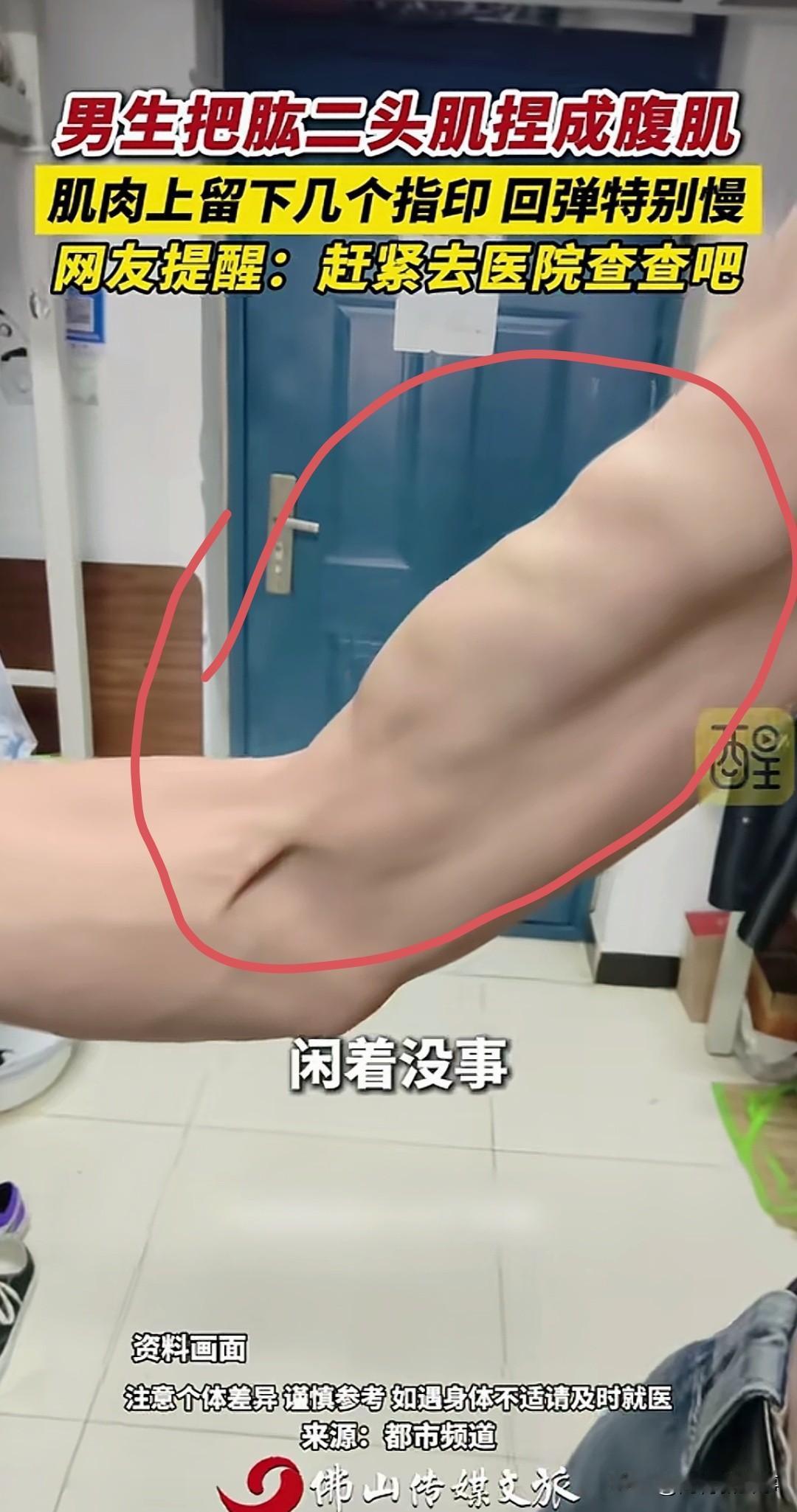身体警告不能忽视！

男生随手按压自己的肱二头肌，竟按出深深指印久久不回弹，没想