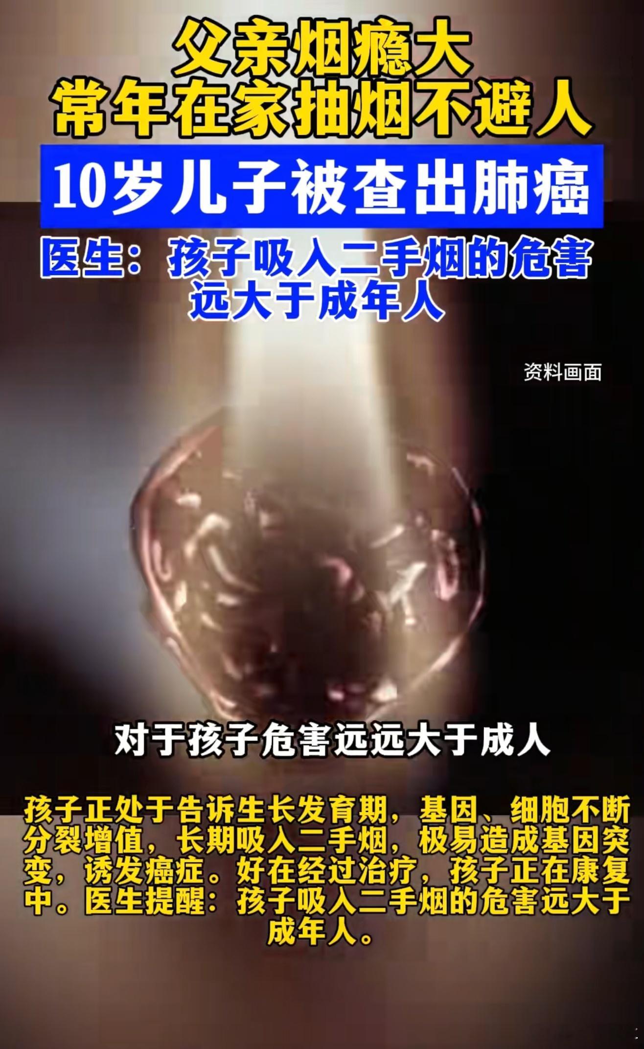 爸爸烟不离手10岁儿子查出肺癌不要在自己家人面前和公共场所抽烟啊，二手烟危害真的