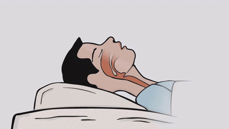 新浪健康必修课 【打呼噜不等于进入深度睡眠】打鼾在许多人眼中被视为深度睡眠的表现