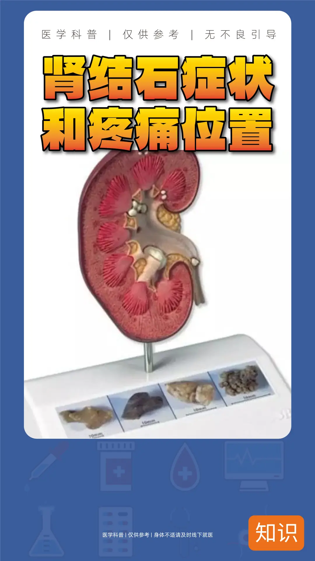 肾结石有哪些症状一张图片告诉你