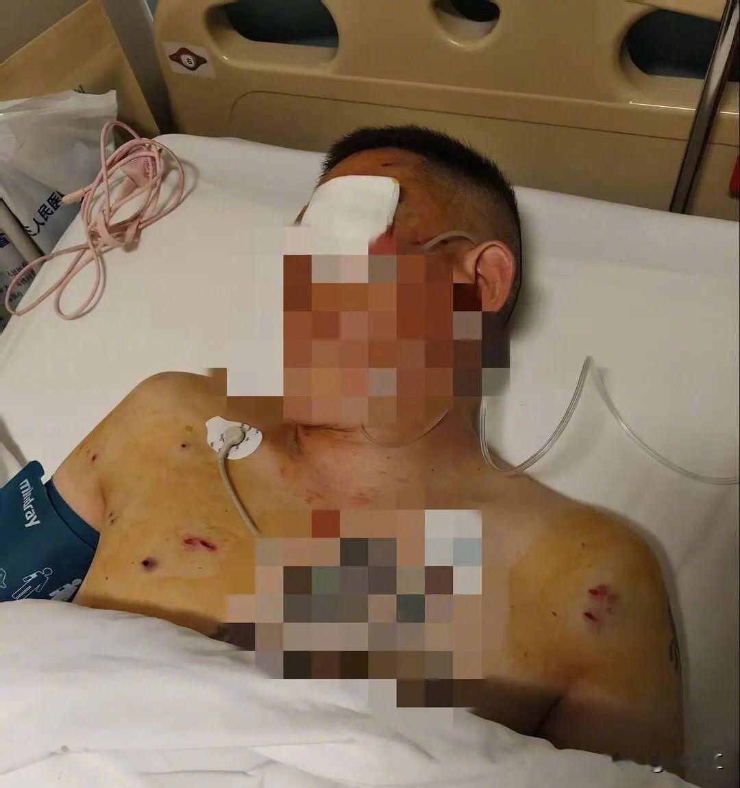 案发经过：
2024年7月2日，倪先生在中国农业银行郑州中牟白沙支行提前预约取款