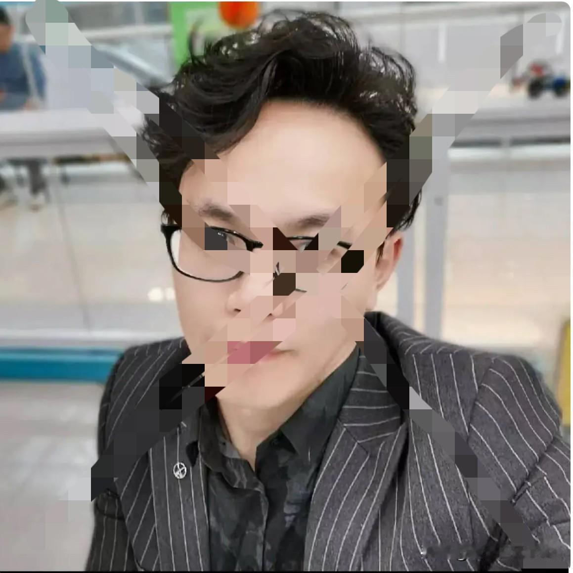 真不知道这个人，厦门四川华西医院的神经外科的兰大夫手艺真差，把我的眼睛做坏了一只